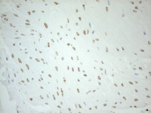 PELI1 Antibody in Immunohistochemistry (Paraffin) (IHC (P))