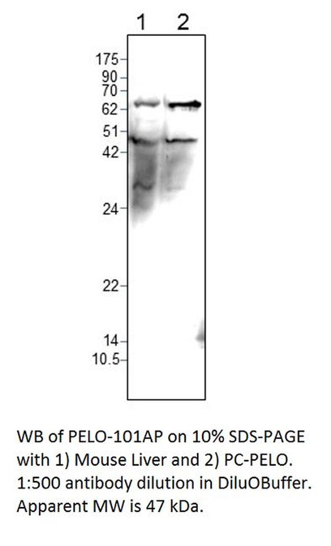 PELO Antibody in Western Blot (WB)