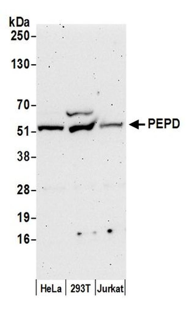 PEPD Antibody in Western Blot (WB)