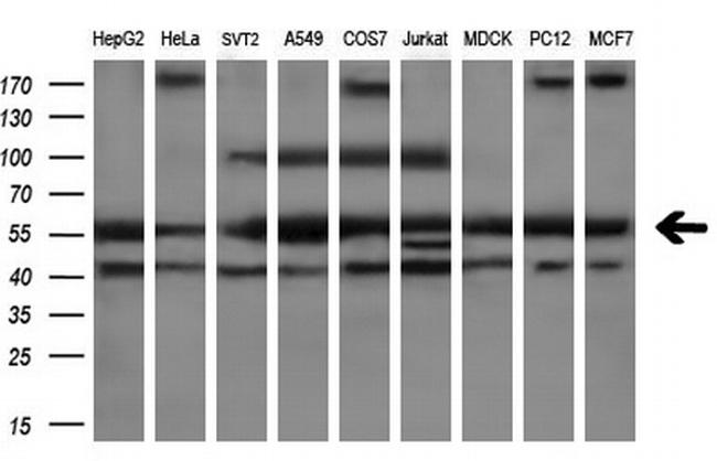 PEPD Antibody in Western Blot (WB)