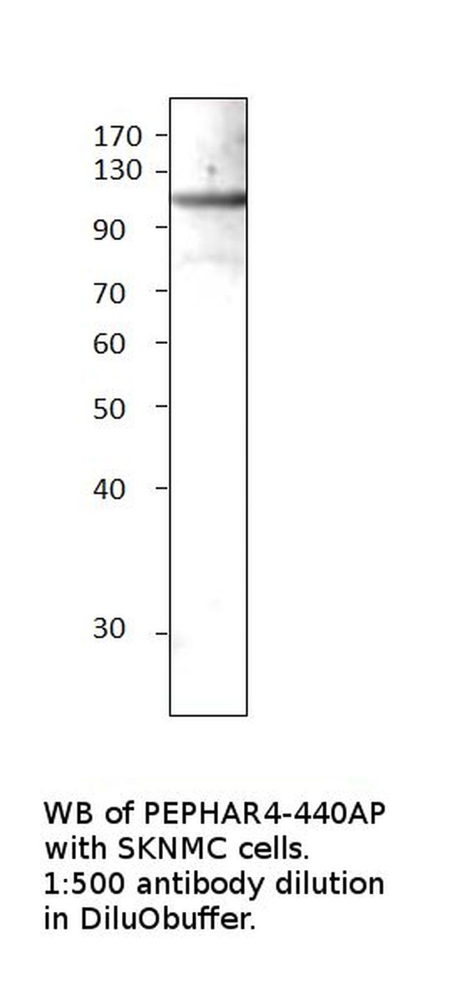 Phospho-Eph receptor A4 (Tyr596) Antibody in Western Blot (WB)