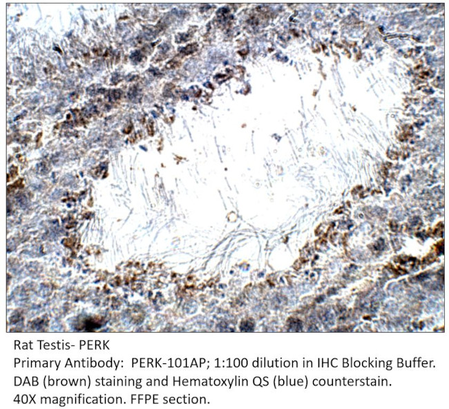 PERK Antibody in Immunohistochemistry (IHC)