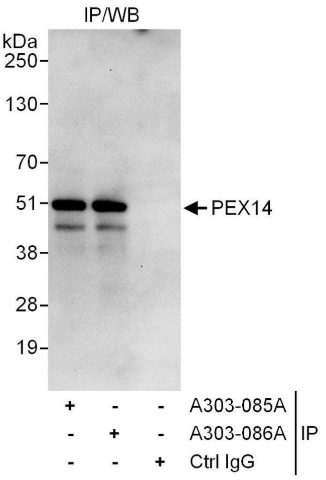 PEX14 Antibody in Immunoprecipitation (IP)