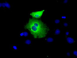 PEX5 Antibody in Immunocytochemistry (ICC/IF)