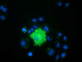 PEX5 Antibody in Immunocytochemistry (ICC/IF)