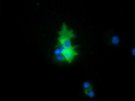 PEX5 Antibody in Immunocytochemistry (ICC/IF)