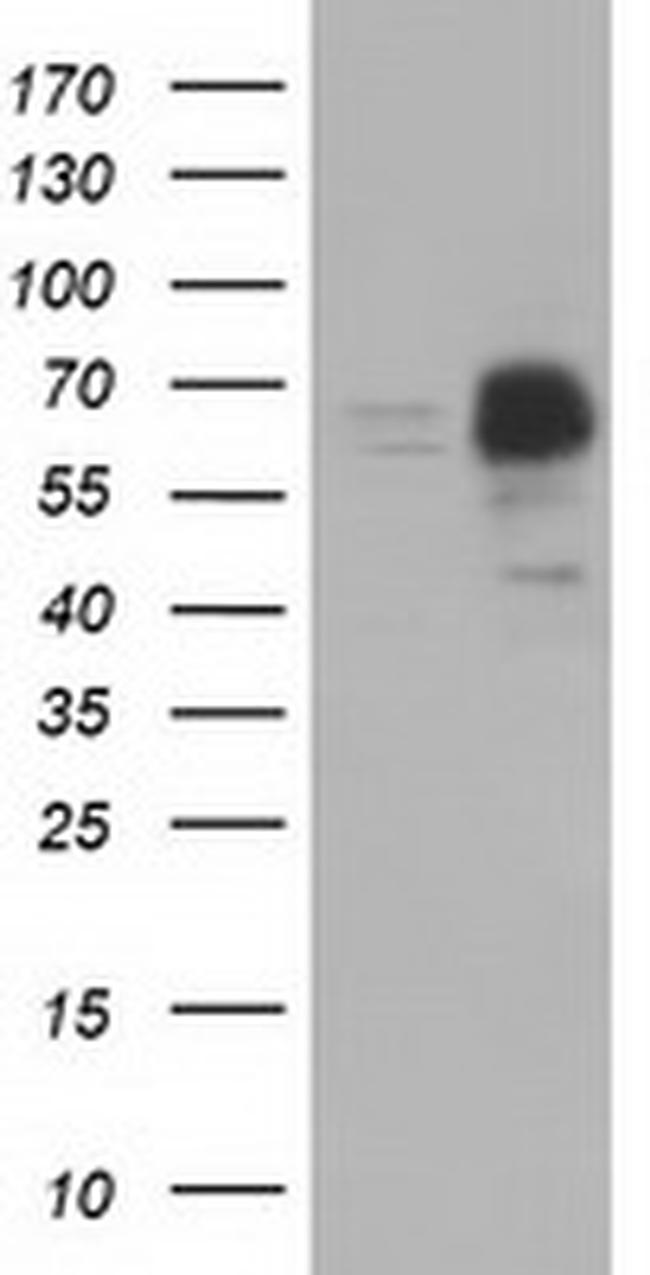 PEX5 Antibody in Western Blot (WB)