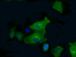 PFKFB4 Antibody in Immunocytochemistry (ICC/IF)