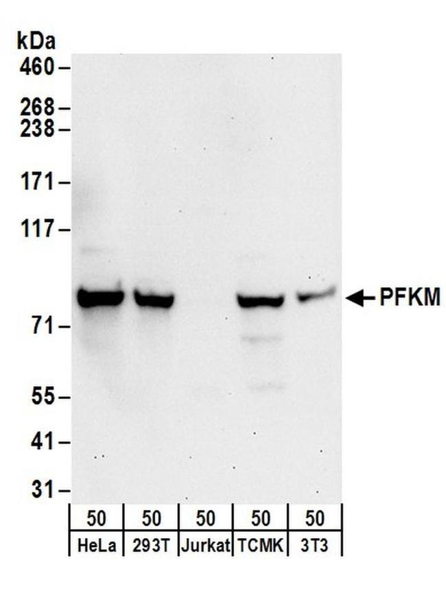 PFKM Antibody in Western Blot (WB)