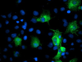 PFKP Antibody in Immunocytochemistry (ICC/IF)