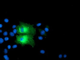 PFKP Antibody in Immunocytochemistry (ICC/IF)