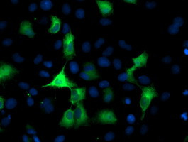 PFKP Antibody in Immunocytochemistry (ICC/IF)