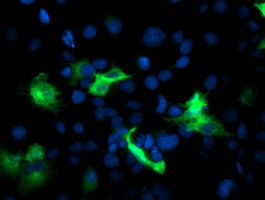 PFKP Antibody in Immunocytochemistry (ICC/IF)