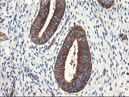 PFKP Antibody in Immunohistochemistry (Paraffin) (IHC (P))