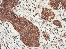 PFKP Antibody in Immunohistochemistry (Paraffin) (IHC (P))