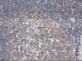 PFKP Antibody in Immunohistochemistry (Paraffin) (IHC (P))