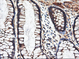 PFKP Antibody in Immunohistochemistry (Paraffin) (IHC (P))