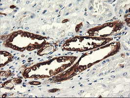 PFKP Antibody in Immunohistochemistry (Paraffin) (IHC (P))