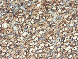 PFKP Antibody in Immunohistochemistry (Paraffin) (IHC (P))