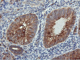 PFKP Antibody in Immunohistochemistry (Paraffin) (IHC (P))