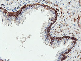 PFKP Antibody in Immunohistochemistry (Paraffin) (IHC (P))