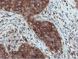 PFKP Antibody in Immunohistochemistry (Paraffin) (IHC (P))