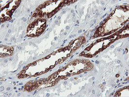 PFKP Antibody in Immunohistochemistry (Paraffin) (IHC (P))