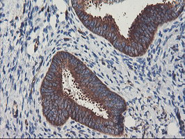 PFKP Antibody in Immunohistochemistry (Paraffin) (IHC (P))