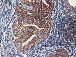 PFKP Antibody in Immunohistochemistry (Paraffin) (IHC (P))