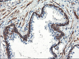 PFKP Antibody in Immunohistochemistry (Paraffin) (IHC (P))