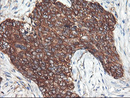 PFKP Antibody in Immunohistochemistry (Paraffin) (IHC (P))