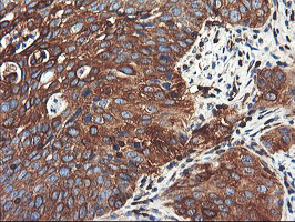 PFKP Antibody in Immunohistochemistry (Paraffin) (IHC (P))