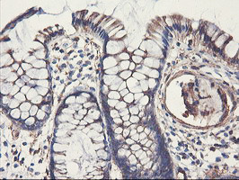 PFKP Antibody in Immunohistochemistry (Paraffin) (IHC (P))