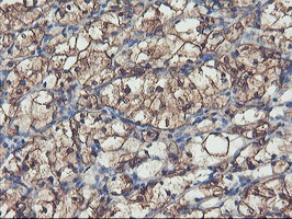 PFKP Antibody in Immunohistochemistry (Paraffin) (IHC (P))