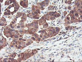 PFKP Antibody in Immunohistochemistry (Paraffin) (IHC (P))