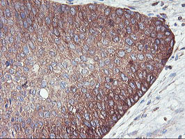 PFKP Antibody in Immunohistochemistry (Paraffin) (IHC (P))