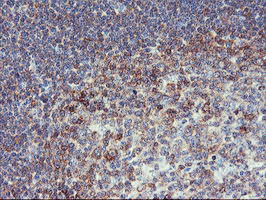 PFKP Antibody in Immunohistochemistry (Paraffin) (IHC (P))