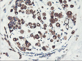 PFKP Antibody in Immunohistochemistry (Paraffin) (IHC (P))