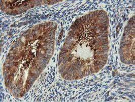 PFKP Antibody in Immunohistochemistry (Paraffin) (IHC (P))