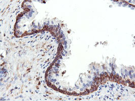 PFKP Antibody in Immunohistochemistry (Paraffin) (IHC (P))