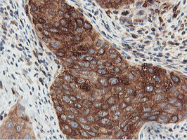 PFKP Antibody in Immunohistochemistry (Paraffin) (IHC (P))