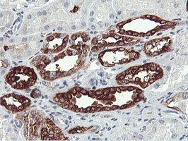 PFKP Antibody in Immunohistochemistry (Paraffin) (IHC (P))