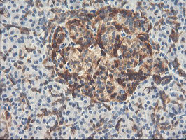 PFKP Antibody in Immunohistochemistry (Paraffin) (IHC (P))