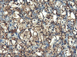 PFKP Antibody in Immunohistochemistry (Paraffin) (IHC (P))