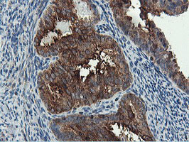 PFKP Antibody in Immunohistochemistry (Paraffin) (IHC (P))