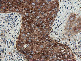 PFKP Antibody in Immunohistochemistry (Paraffin) (IHC (P))