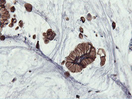 PFKP Antibody in Immunohistochemistry (Paraffin) (IHC (P))