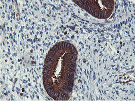 PFKP Antibody in Immunohistochemistry (Paraffin) (IHC (P))