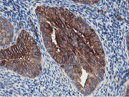 PFKP Antibody in Immunohistochemistry (Paraffin) (IHC (P))