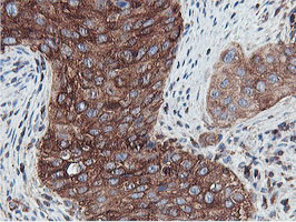 PFKP Antibody in Immunohistochemistry (Paraffin) (IHC (P))